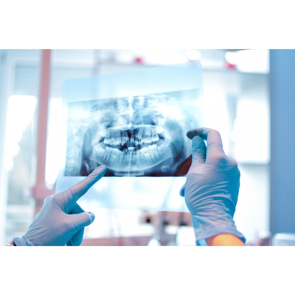 Radiologia e Imaginologia Odontológica